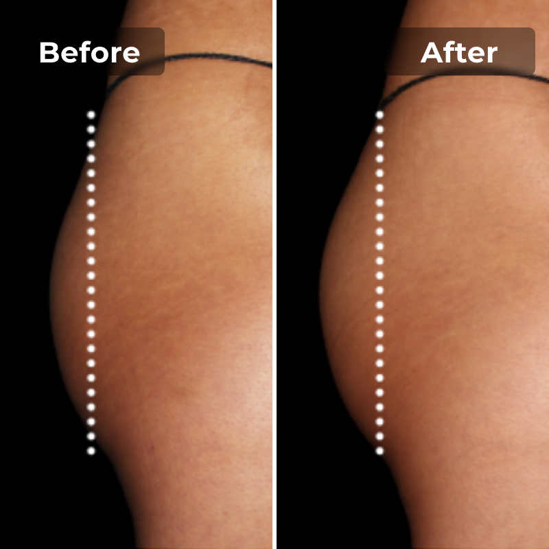 Malkiwi EMS Toning Shorts