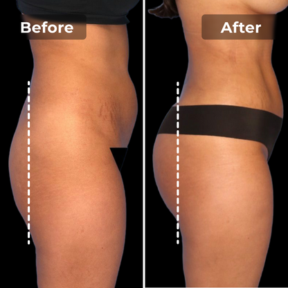 Malkiwi EMS Toning Shorts